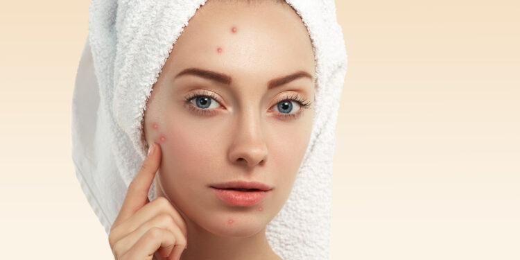 white-spots-on-skin-causes-treatments