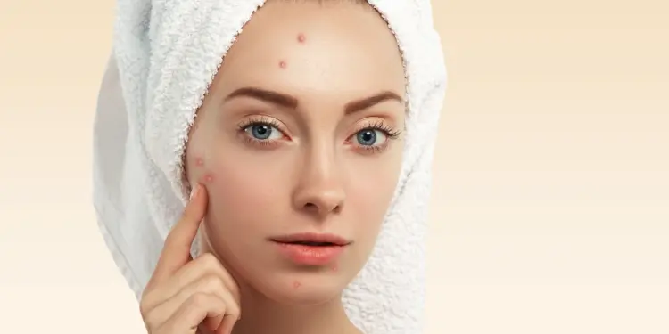 White Spots in The Skin: Causes And Treatments