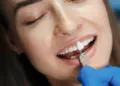 dental veneers for missing teeth